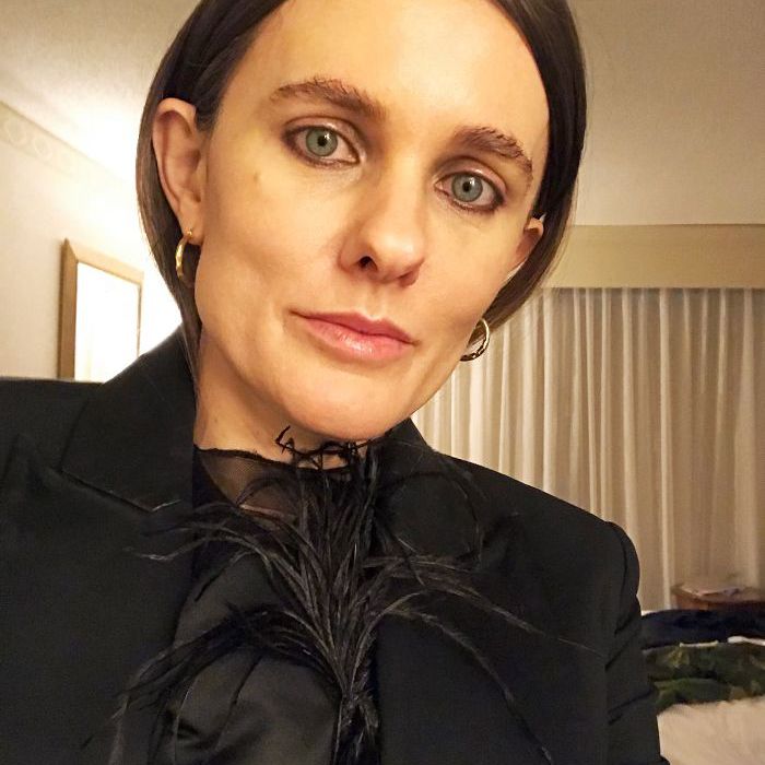 什么是唇部填充物- sacha Strebe