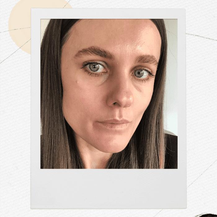 在眼眶填充物- sacha Strebe之前